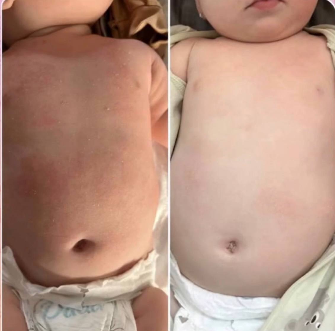 Before and after: appearance and condition of a baby's skin