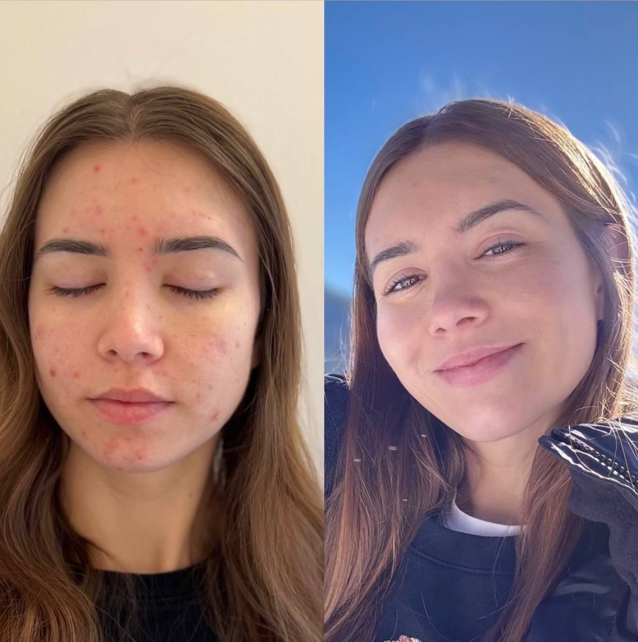 Svetlana: before and after photos — changes in wellbeing and lifestyle